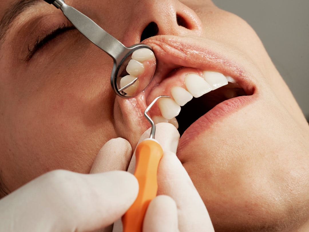 Teeth Cleaning and Prevention