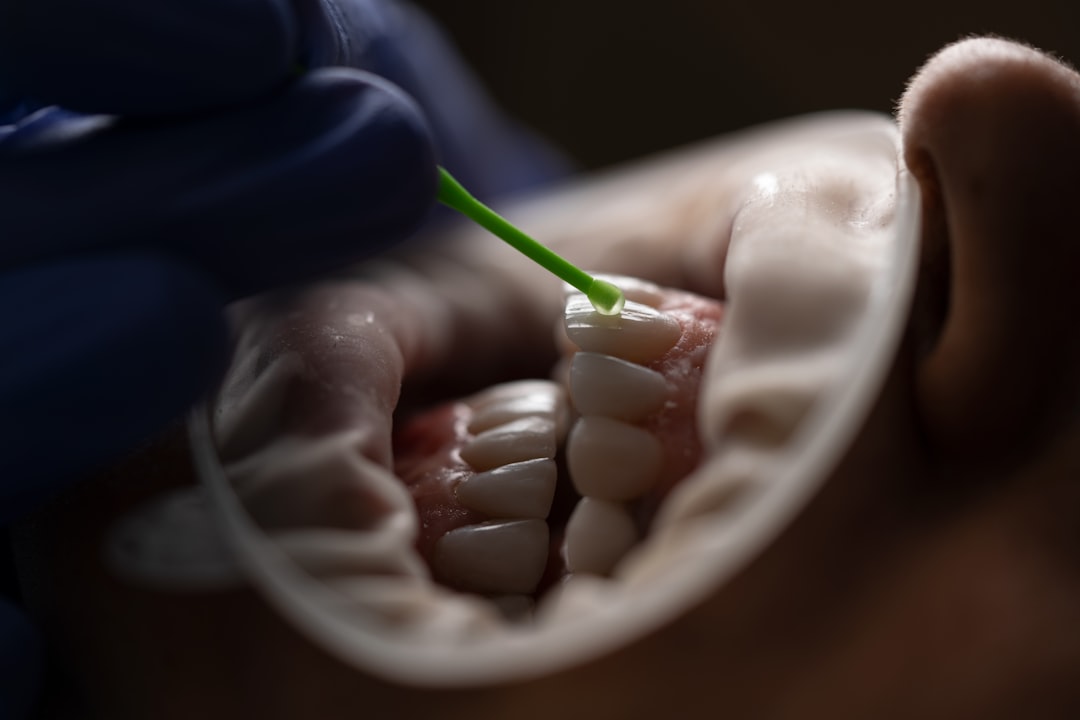 Fillings, Inlays and Onlays