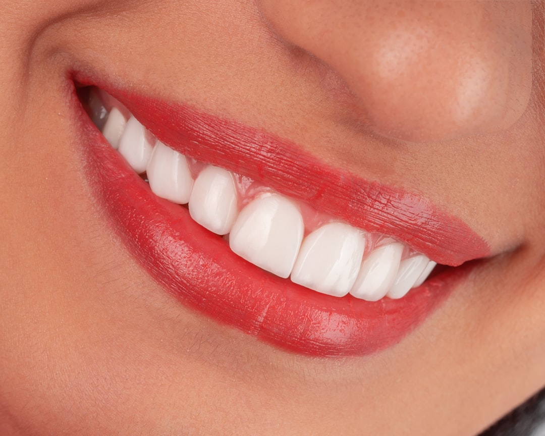 Zoom! Teeth Whitening